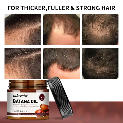 Hair Growth Batana Oil Unrefined Raw for Enhance Efficacy for