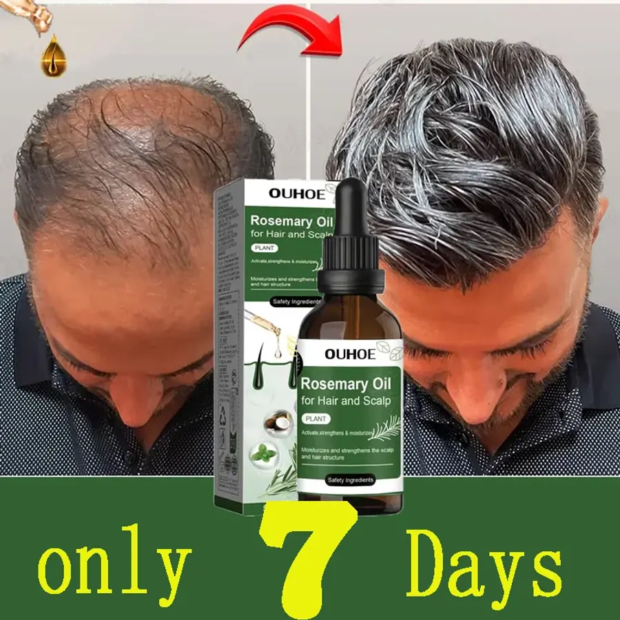 Rosemary Hair Growth Oil Anti Hairs Loss Treatment Mint Hair