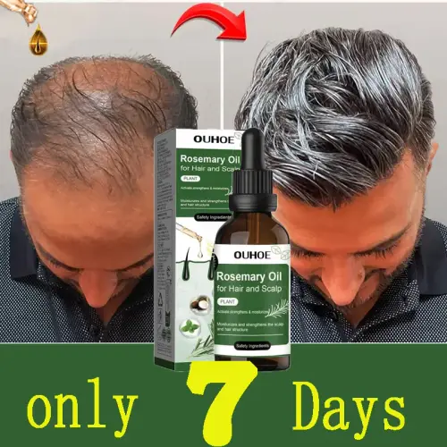 Rosemary Hair Growth Oil Anti Hairs Loss Treatment Mint Hair