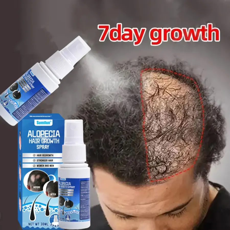 Fast Hair Growth Serum Spray Anti Hair Loss Prevent Baldness